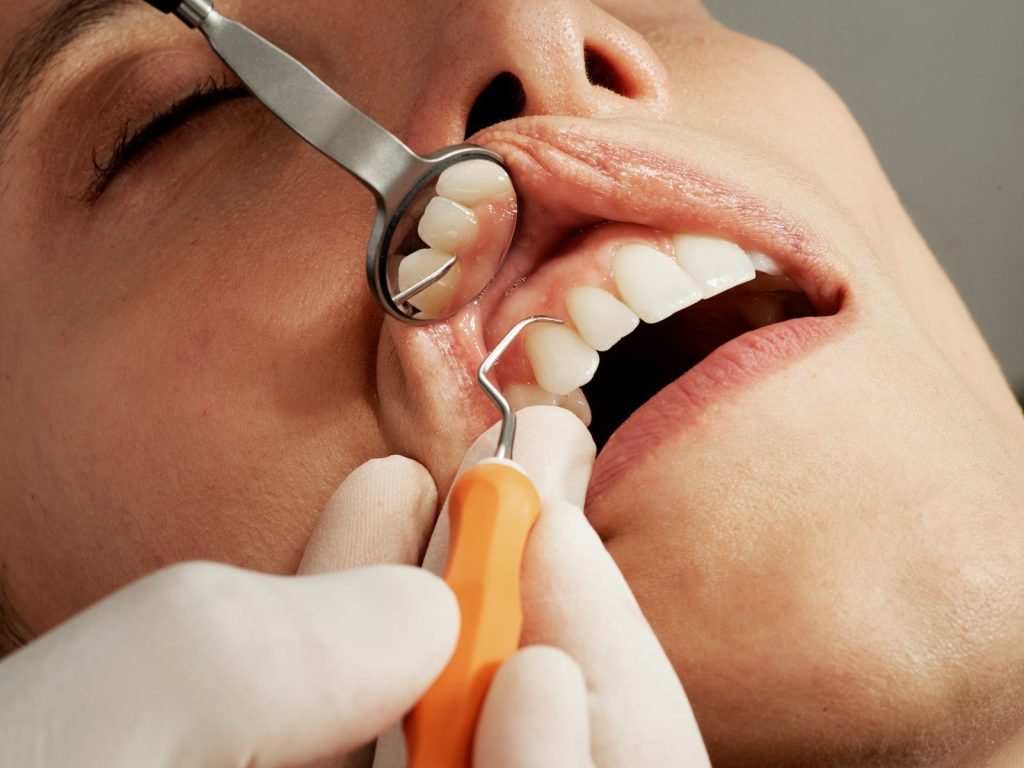 dental exam with mirror and tool